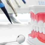 Різниця між одноетапним та двоетапним протезуванням зубів